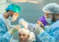 Everything You Need to Know About FUE Hair Transplants in London
